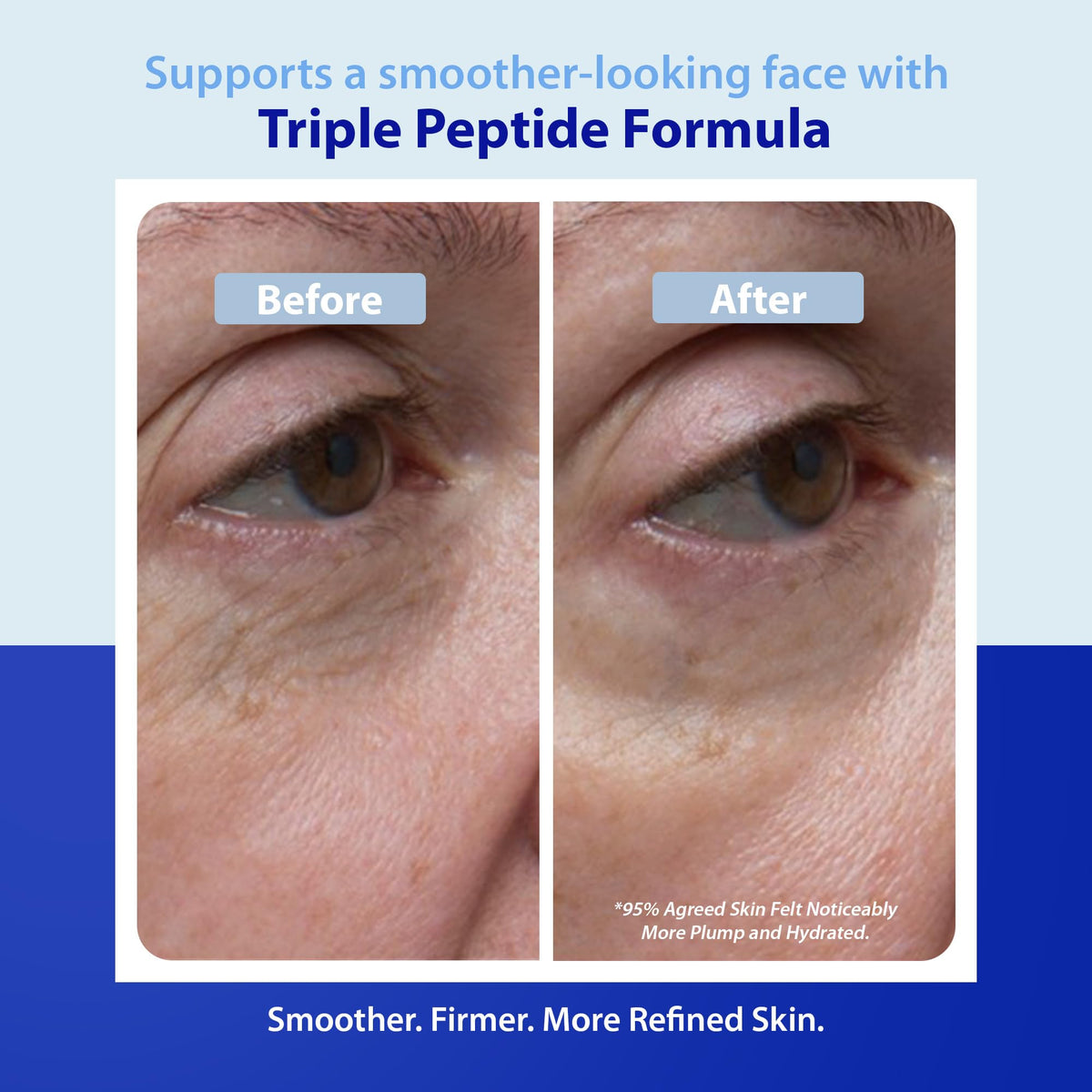 Dr. Denese SkinScience Triple Strength Wrinkle Smoother Advanced Treatment Combines Natural Extracts with Enhanced Peptide Technology To Tighten & Firm Skin - Paraben-Free Cruelty-Free 3.4oz